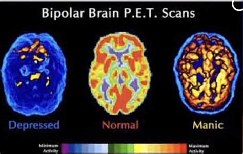 If you love me, please read about Bipolar Disorder.